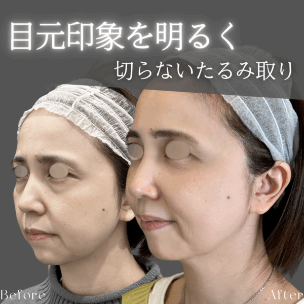 No.9122の症例写真